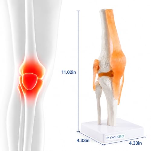 Image of ✮ Knee Joint Model With Ligaments (Flexible) ✮ ACL, PCL, LCL & MCL Are Accurately Depicted ✮ Comes Without Any Deformity