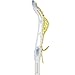StringKing Women’s Complete Lacrosse Stick with Composite Shaft and Women's Type 4 Mesh (White/Yellow)