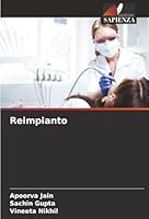 Reimpianto (Italian Edition) 6200749213 Book Cover