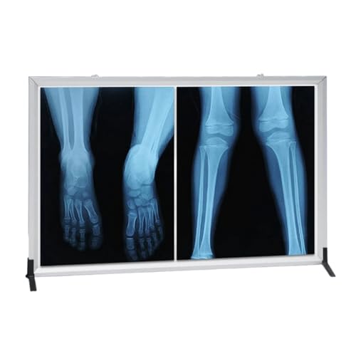 X-ray Film Illumination Light Box - Generic