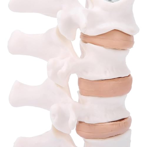 Modèle de spine pathologique lombaire AMITD en taille réelle avec base - 4