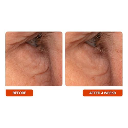 13 Best Treatments to Reduce Pore Size for Women Over 50 3 BeautyStat Universal C Skin Refiner - Vitamin C Serum for Face, 20% Pure L-Ascorbic Acid - Created by a 20+ Year Skincare Veteran Cosmetic Chemist (30ml / 1.0 oz)