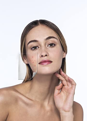 Miss Aura Best Acne Kit For Clearing Up Breakouts - Daily Facial Cleansing Bar & Dead Sea Mud Mask For Acne-Prone & Oily Skin Both With Advanced Salicylic Acid Helps Reduce Symptoms Of Acne #TOP2