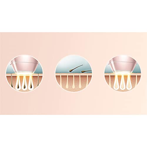 Philips Lumea Prestige IPL-Haarentfernungsgerät mit SmartSkin-Sensor (Modell BRI954/00 ) - Image 5