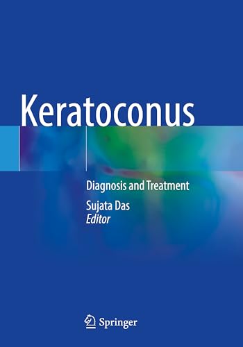 Keratoconus: Diagnosis and Treatment