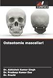Osteotomie mascellari...