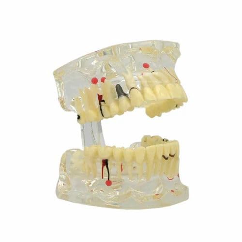 Dental Educational Model Teeth Set Pack Of 1 Piece-picture-10