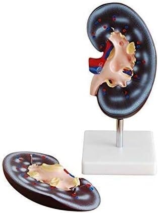 Modèle de rein humain d'anatomie médicale structures détachables luxe