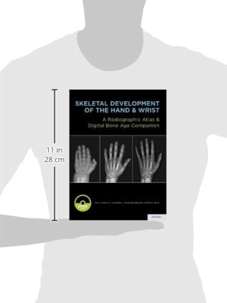 健康・医学 A Comprehensive Atlas of Hand Surgery Atlas of Hand Surgery: Conolly, W. Bruce: 9780443050770