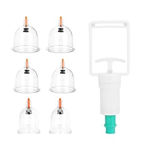 Vakuum Saug Schröpfen Kit, Schröpfen Set, 6 Teile/los Tassen Chinesischen Schröpfen Sets Gerät Vakuum Körper Schröpfen Dosen Gesunde Massage