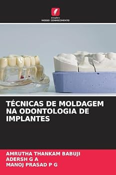 Técnicas de Moldagem Na Odontologia de Implantes (Portuguese Edition)