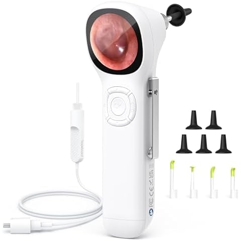 ScopeAround Digital Otoscope Cover