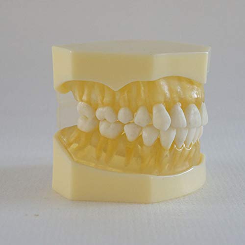 28 Teeth Removable Standard Dental Model (Removable Standard Dental Model (28pcs Teeth,Soft Gum))
