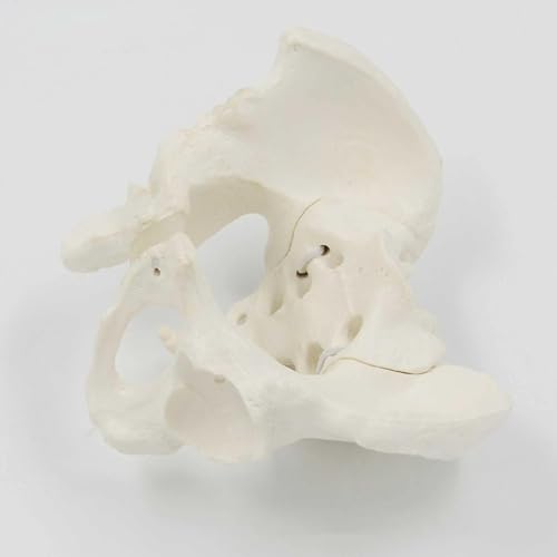 Modelo de pelvis mini para explicar lesiones de cadera de forma visual y clara 6