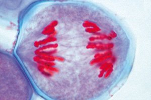 3B Scientific GmbH W13054 Genetic Microscope Slides Set of 25, Grade: 1 to 2