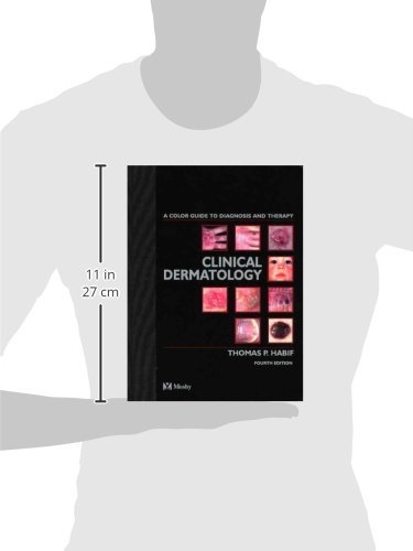 Clinical Dermatology: A Color Guide to Diagnosis and Therapy