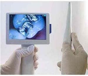 PatientView All-In-One Dental Camera + Display