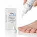 NailRENEW Antifungal - Professional Strength, FDA-Compliant, Fungus Treatment for Toe Fungus, Discolored or Brittle Nails.