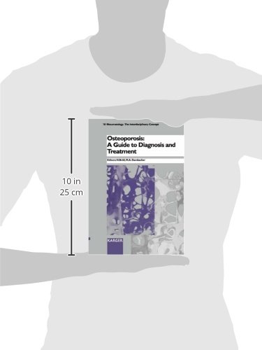 Osteoporosis: A Guide to Diagnosis and Treatment (RHEUMATOLOGY)      First Edition