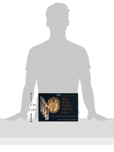 National Library of Medicine Atlas of the Visible Human Male: Reverse Engineering of the Human Body