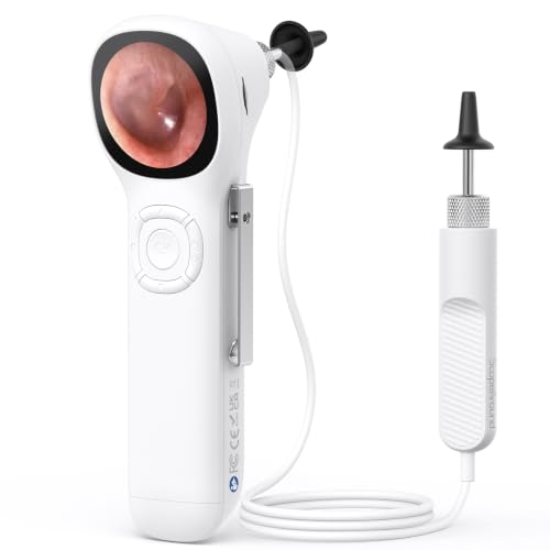 Otoscopio con luz, sin necesidad de app, pantalla HD, cámara para oído para familia miniatura 1