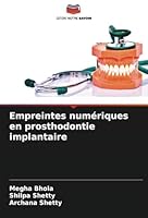 Empreintes numériques en prosthodontie implantaire (French Edition) 3330825685 Book Cover