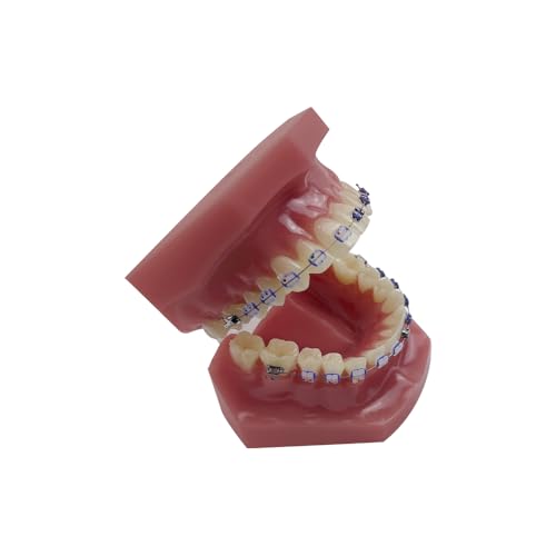 Orthodontisches Zahnmodell mit Halterungen, YOUYA DENTAL Demonstration Orthodontisches Modell für Bildung, Zähne Demonstration Typodonte Anatomisches Lehrwerkzeug mit Metall und Keramischer Halterung