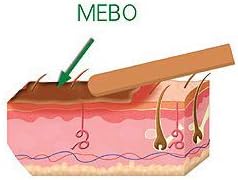 Miniatura 3 de MEBO Crema para quemar la piel Ungüento curativo para heridas y cicatrices sin marcas Cuidado rápido de primeros auxilios para la salud Cuidado de