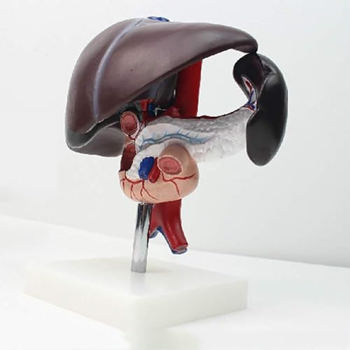 Modèle de pathologie du pancréas AMITD aide à l'apprentissage digestif en anatomie