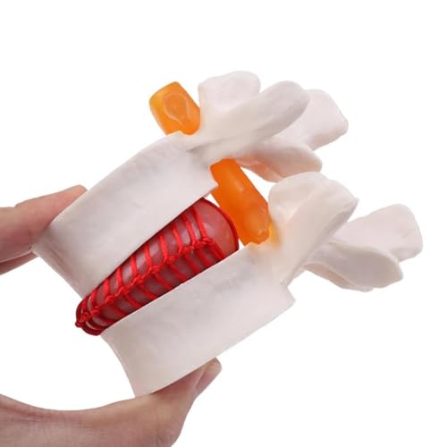 Image of Human Anatomical Lumbar Disc Herniation Model,1.5 Times Life Size Portable Lumbar Vertebrae Model ，Anatomy Medicine Teaching Tool for Medical Learning and Scientific Presentations