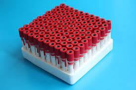 BCT Plain Tube 12x75mm Non vacuum (Pack of 100) (Red)-image-13