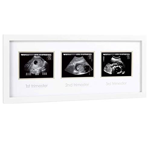 Image of Pearhead Pregnancy Trimester Sonogram Frame, Ultrasound Picture Frame, Pregnancy Milestone Keepsake Photo Frame, Sonogram Keepsake, Gender-Neutral Baby Nursery Décor, 1st 2nd and 3rd Trimester, White