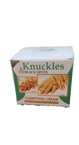 Knuckles & Black Spots Clarifying Cream