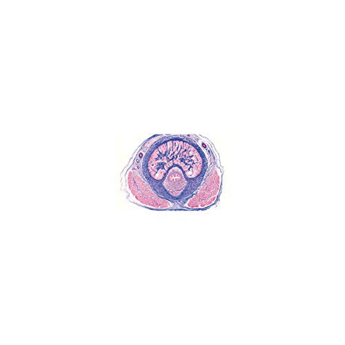 Image of 3B Scientific GmbH W13315 Urinary System-German