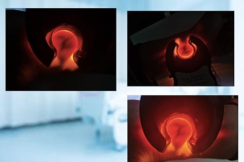 Image of Portable Infrared Vein detector for Adults and Children | Accurate Vein Detection for Medical Use