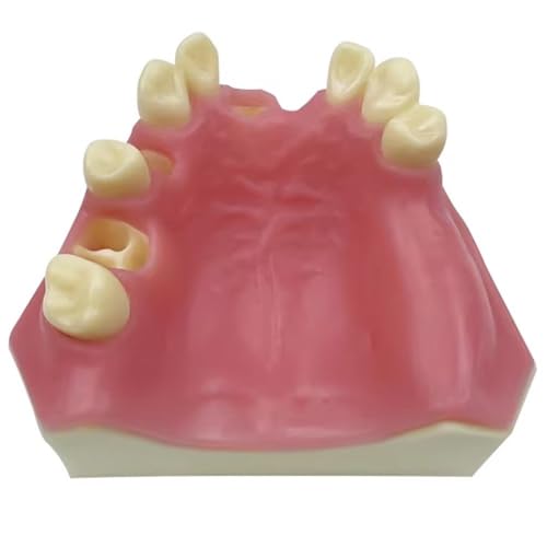 Modelo dental tipodonto para aprender restauración de sobredentaduras 2