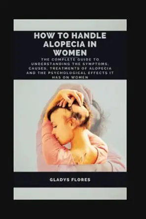 HOW TO HANDLE ALOPECIA IN WOMEN: The Complete Guide To Understanding The Symptoms, Causes, Treatments Of Alopecia and The Psychological Effects It Has On Women-Wow! eBook