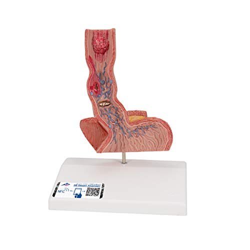 Maladies de l'œsophage K18 moulage anatomique pour étude médicale