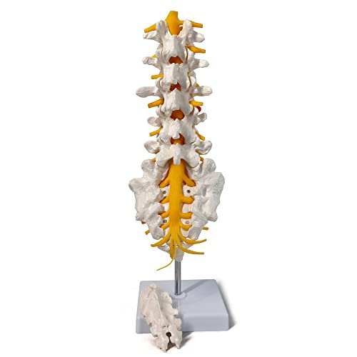 Image of EVOTECH SCIENTIFIC Lumbar Spine Anatomy Model with Sacrum and Spinal Nerves, Didactic Replica of Lumbosacral Section with Nerves and A Herniated Disc At L4, Includes Base for Medical Teaching Display