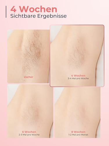 21J IPL Geräte Haarentfernung mit 8℃ Eiskühlsystem, Laser Haarentfernung 9 Stufen & 600 NM Rotlicht, LCD-Touchscreen IPL Haarentfernungsgerät für Frauen Männer, Gesicht Arm Bikinizone Körper, Rose 6