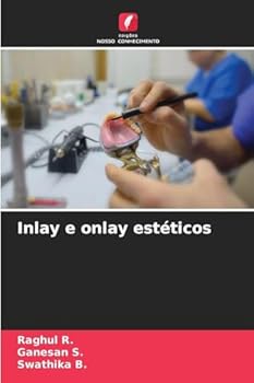 Inlay e onlay estéticos (Portuguese Edition)