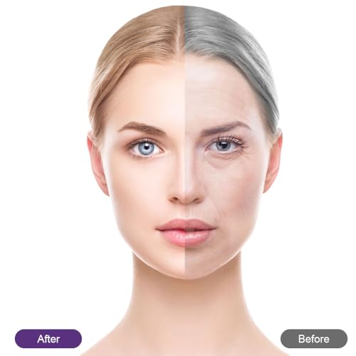 LOPHE Triangle Wrinkle Patches, Anti Wrinkle Facial Patches, Anti Wrinkle Tape, Wrinkles treatment - Image 4