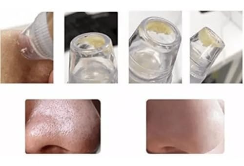 Removedor de Cravos Extrator Sugador Espinhas Poros Cleaning Acne a Vácuo Elétrico Aparelho Sucção D