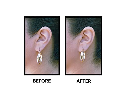 Lobe Wonder Ear Lobe Support Patches -- 60 Ct. #TOP6