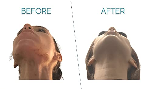 iSF-Therapeutic-Skin-Cream-Deep-Hydrating-Calming-Moisturizer-to-Protect-and-Nourish-Sensitive-Skin-and-Sensitive-Eyes-Anti-Allergenic-Fragrance-Free-Formula-2-Fl-Oz-60-ml