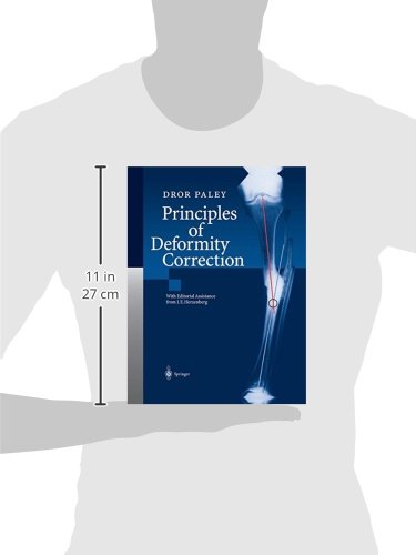 Principles of Deformity Correction - Thumbnail 3