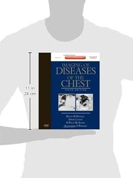 健康・医学 Common Diseases Up to date 817nZg1n4SL._UF350,350_QL50_.jpg