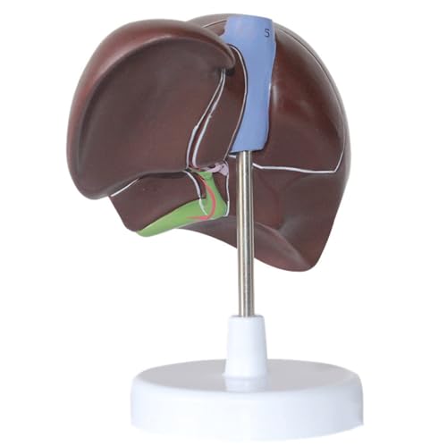 Modèle 3D liver pathology AMITD avec socle pour l'apprentissage de l'anatomie médicale