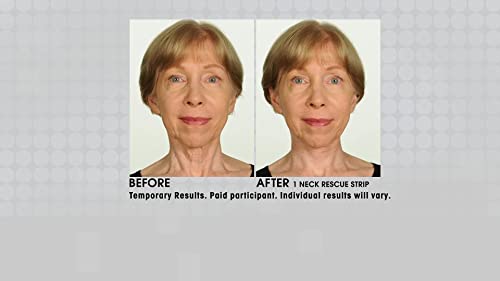 Contours Rx Neck Rescue - Instant Correcting Strips For Loose Skin, Tightens Neckline Appearance, 30 Count #TOP4