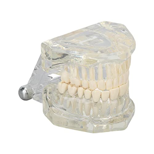 NSXAYIWE Dental Oral Typodont, Lernzahnmodell Mit Klarer Struktur, Standard-Zahnzahnmodell, Zahnmodell Kompatibel Für Zahnärzte, Lehrer Und Studenten